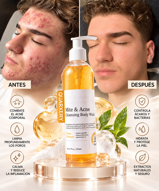 Quarxery Mite Y Acne 250ml